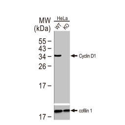 Cyclin D1 antibody [N1C3]